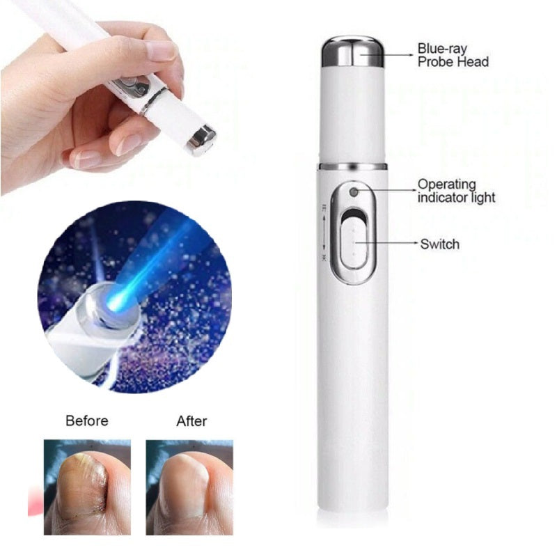 Laser Pen For Repairing Gray Nails