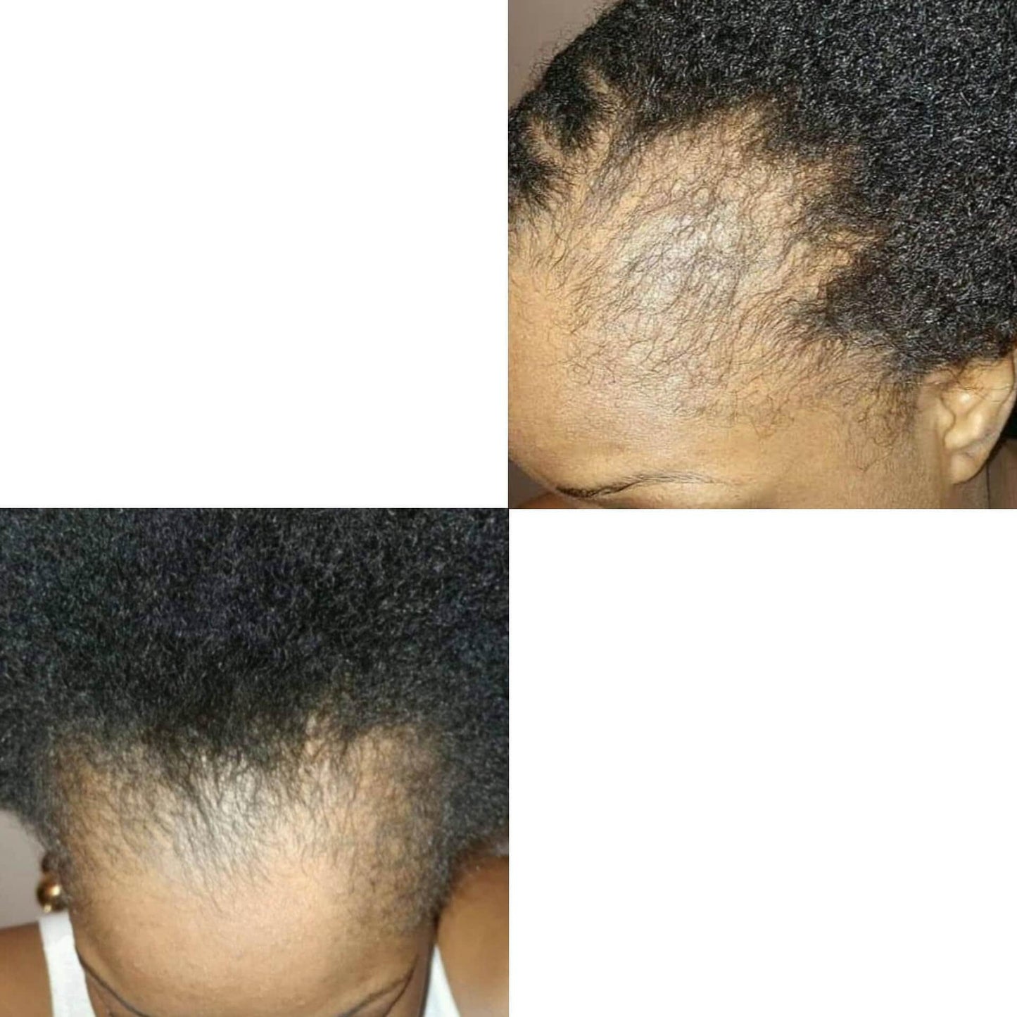 Peppermint Hair Moisturizing Hair Butter (Peppermint Oil, Lavender Oil, Tea Tree Oil, Hemp Oil, Alma Oil, Sage Oil, Clove Oil, Vitamin E Oil, Rosemary Oil, Black Seed Oil, Jamaicia Casto oil, Indian Casto Oil, Aloe Oil, Lemon