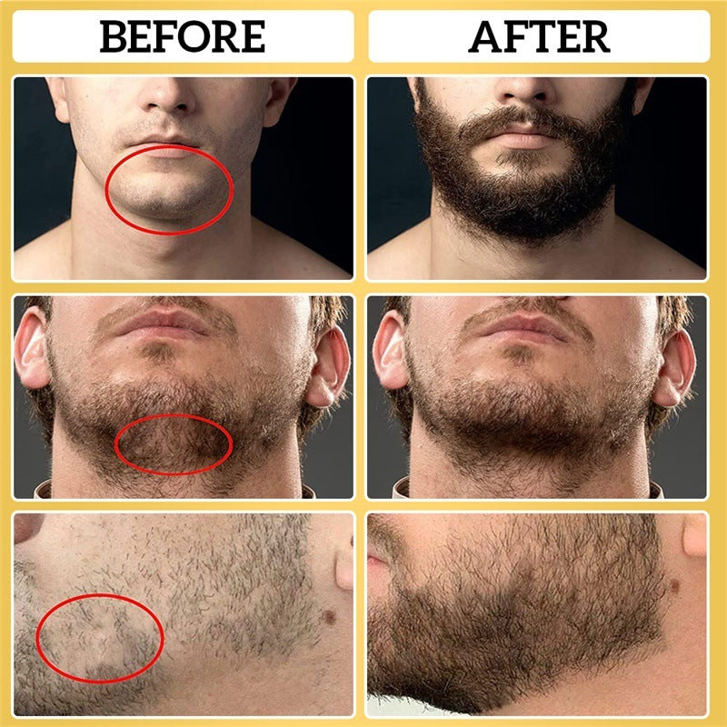 Men's Beard Oil Moisturizing