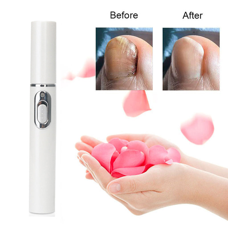 Laser Pen For Repairing Gray Nails